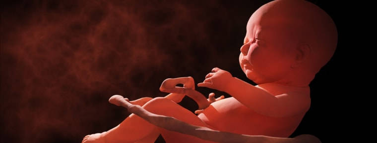 Birth-injury rates static as pay-outs rise exponentially