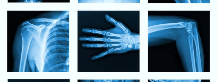 Radiation scrutiny transfers to HIQA